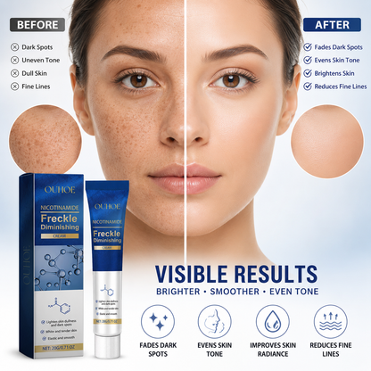 ⭐OUHOE Dark Spot Correcting Cream 🔥Removes All Types of Dark Spots -OKL